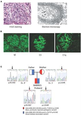 Immune Dysregulation Mimicking Systemic Lupus Erythematosus in a Patient With Lysinuric Protein Intolerance: Case Report and Review of the Literature